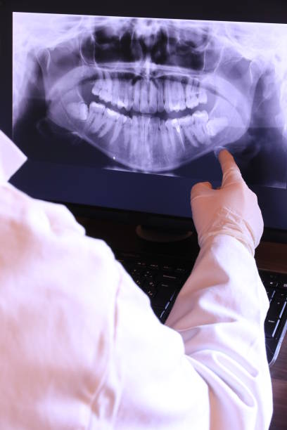 Best Emergency Dental Care for Broken or Chipped Teeth in Marion, VA