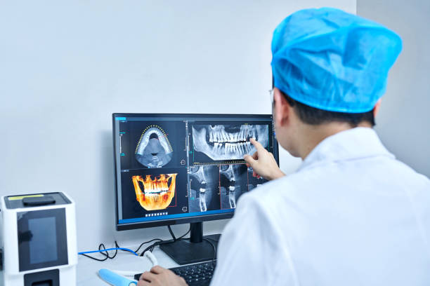 Best Emergency Wisdom Teeth Removal in Marion, VA